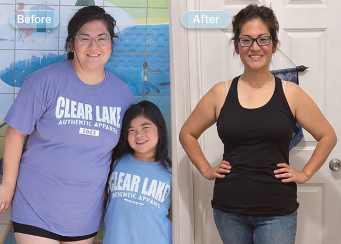 Abby before and after